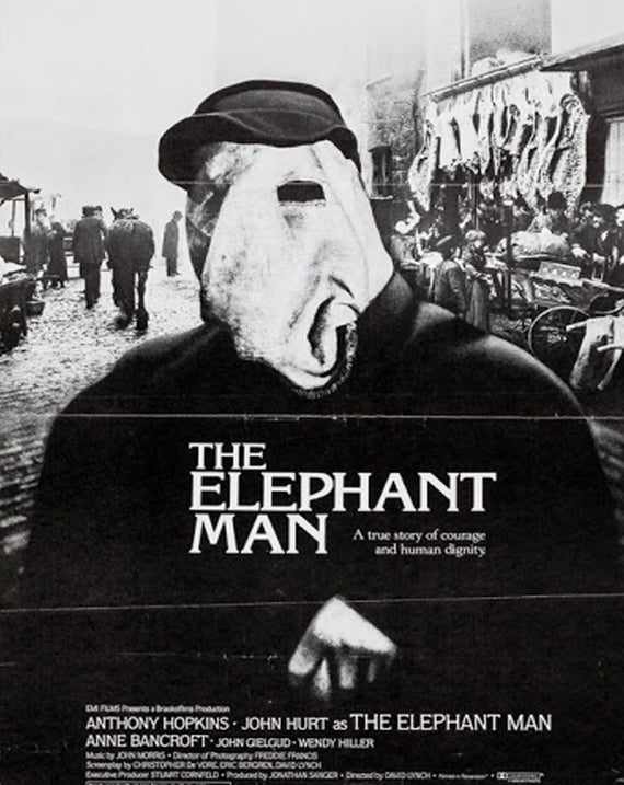 The Elephant Man